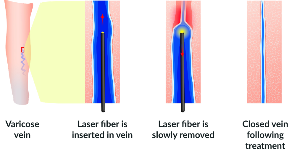 Vein Clinic Image